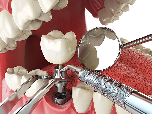 Reliable TX Emergency Dentist Solutions